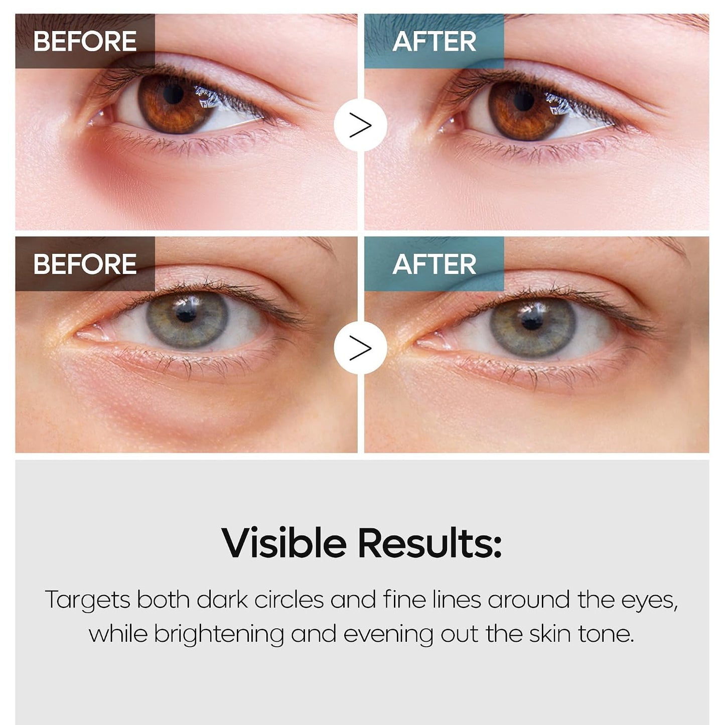 Korean TX Dual Eye Cream