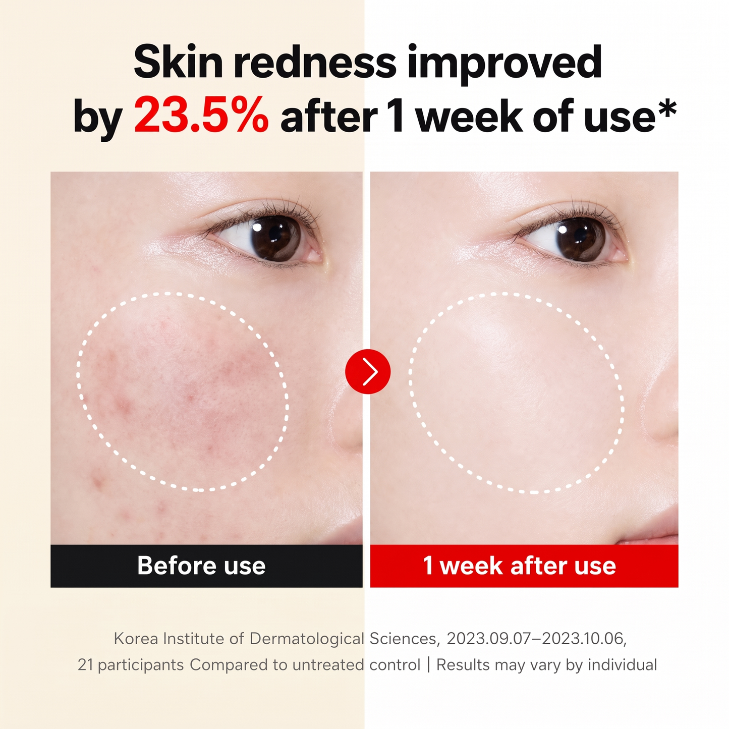 Korean Madeca Time Reverse Cream